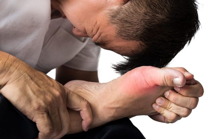 Bệnh gout xảy ra khi các tinh thể urate tích tụ trong khớp
